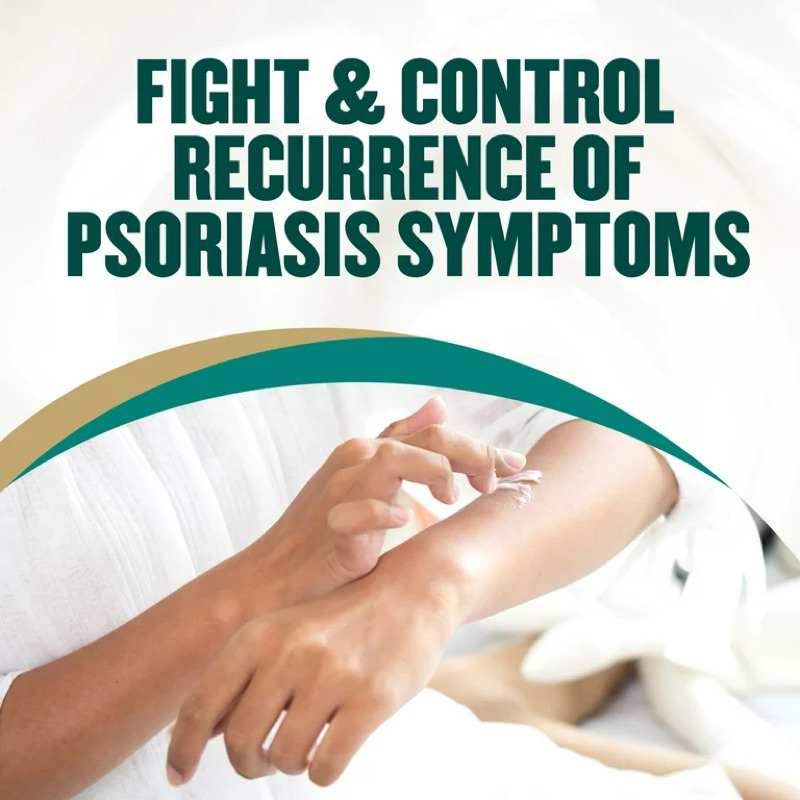 Kem dưỡng cho da kích ứng, vảy nến Gold Bond Psoriasis Multi-Symptom Relief