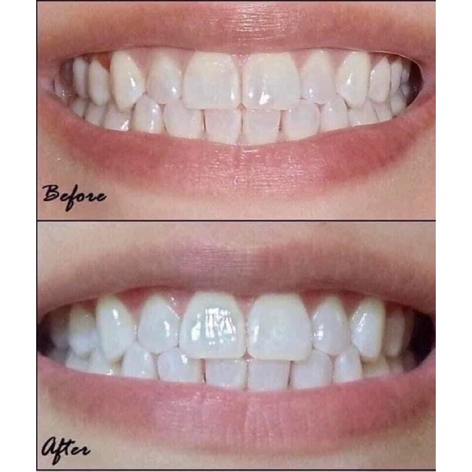 Kem đánh răng Crest 3D White tẩy trắng răng