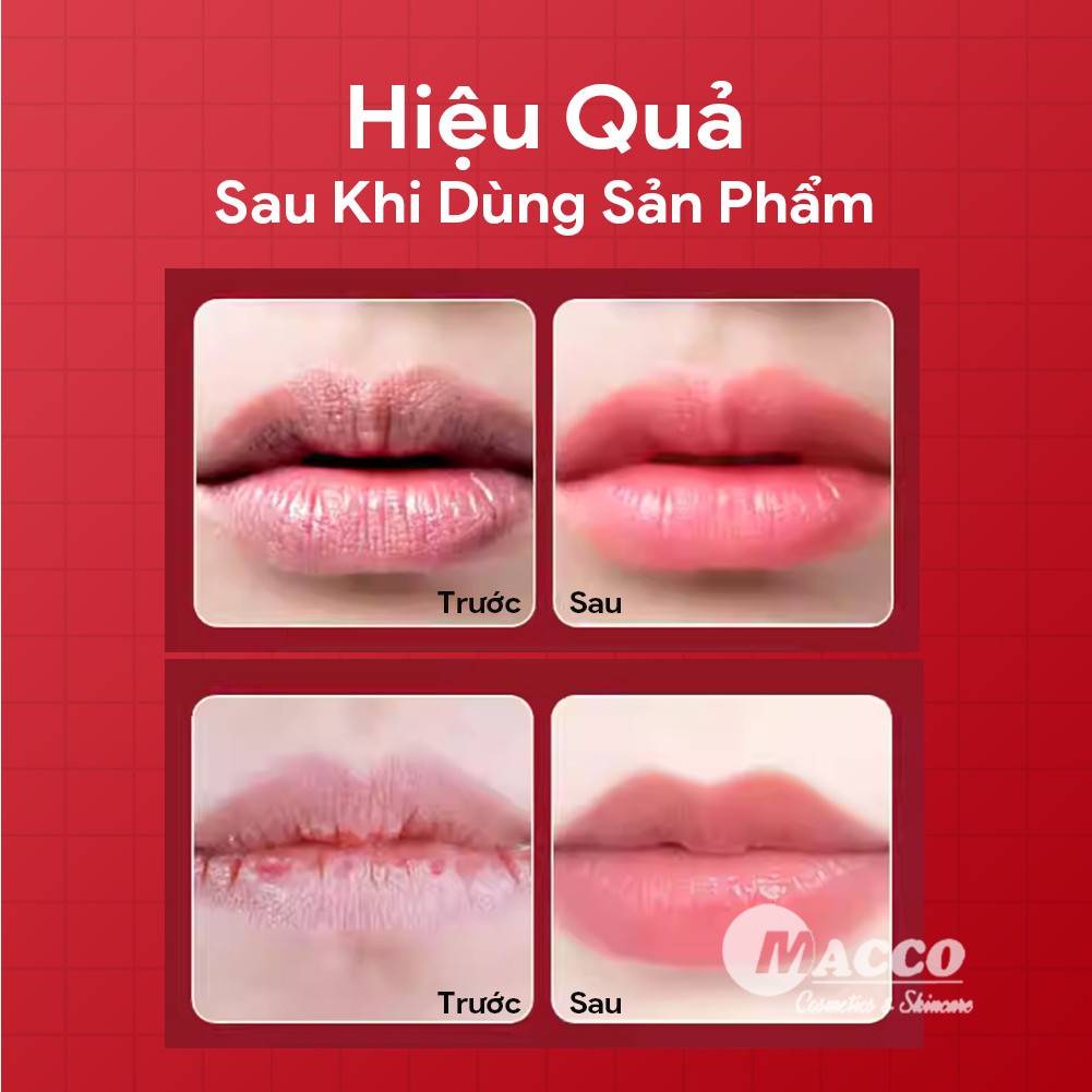 Mặt Nạ Môi Sủi Bọt HUNMUI / LDA Tẩy Tế Bào Chết, Làm Hồng Môi, Giảm Thâm, Cho Đôi Môi Mềm Mại