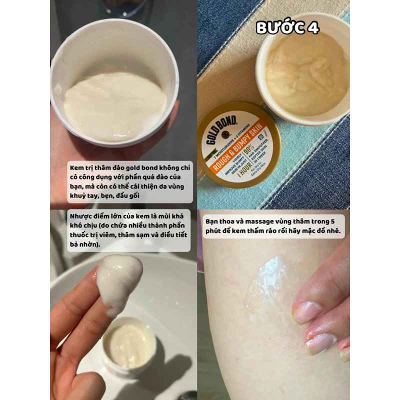 Kem dưỡng Gold Bond Rough and Bumpy Skin dành cho da sần sùi, da gà, viêm nang lông