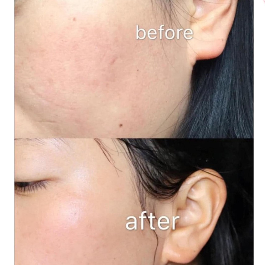 Kem dưỡng Olay Total Effects 7in1