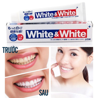 Kem đánh trắng răng White & White 150g