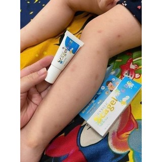 Kem bôi sẹo thâm scagel thái lan