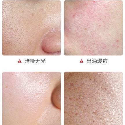 Kem trắng da se khít lỗ chân lông hết mụn nám tàn nhang, bật tông trắng được làm từ sâm nấm đông trùng hạ