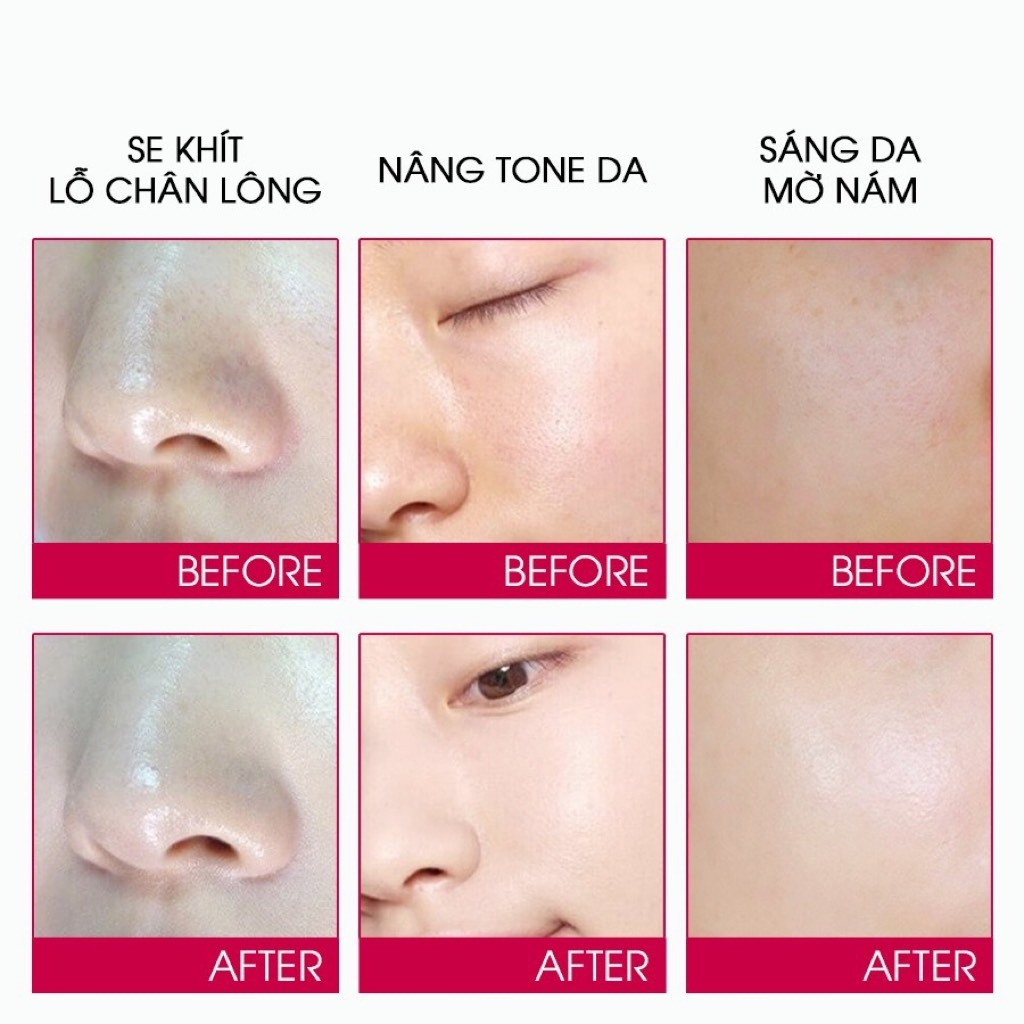 Kem dưỡng trắng nâng tone chứa Glutathione, Niacimamide, mờ thâm sạm, nám, đốm nâu Mediheal