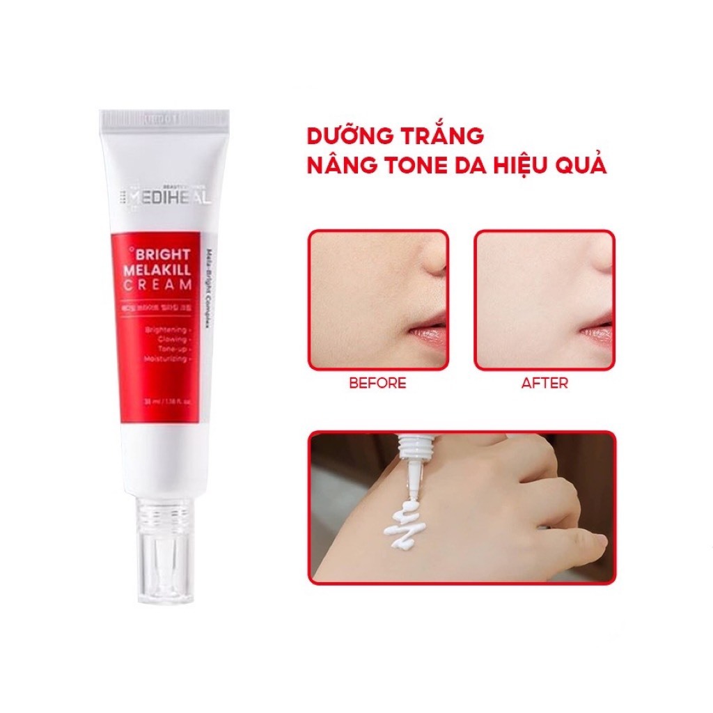 Kem dưỡng trắng nâng tone chứa Glutathione, Niacimamide, mờ thâm sạm, nám, đốm nâu Mediheal
