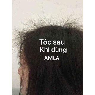 cặp gội xả amla detox