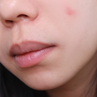 [144 miếng] Miếng dán mụn Olive Young Care Plus Spot Patch