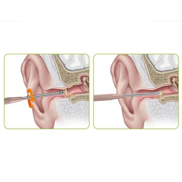 Dụng cụ lấy ráy tai - Đồ lấy ráy tai 2 đầu