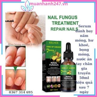 Serum đánh bay nấm móng, hư khoé, bọng móng, nước ăn tay chân gia truyền 50ml hiệu quả sau 7 ngày