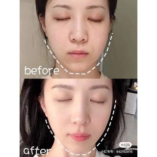 Refa carat [100% AUTHENTIC]_ Thanh lăn thon gọn mặt