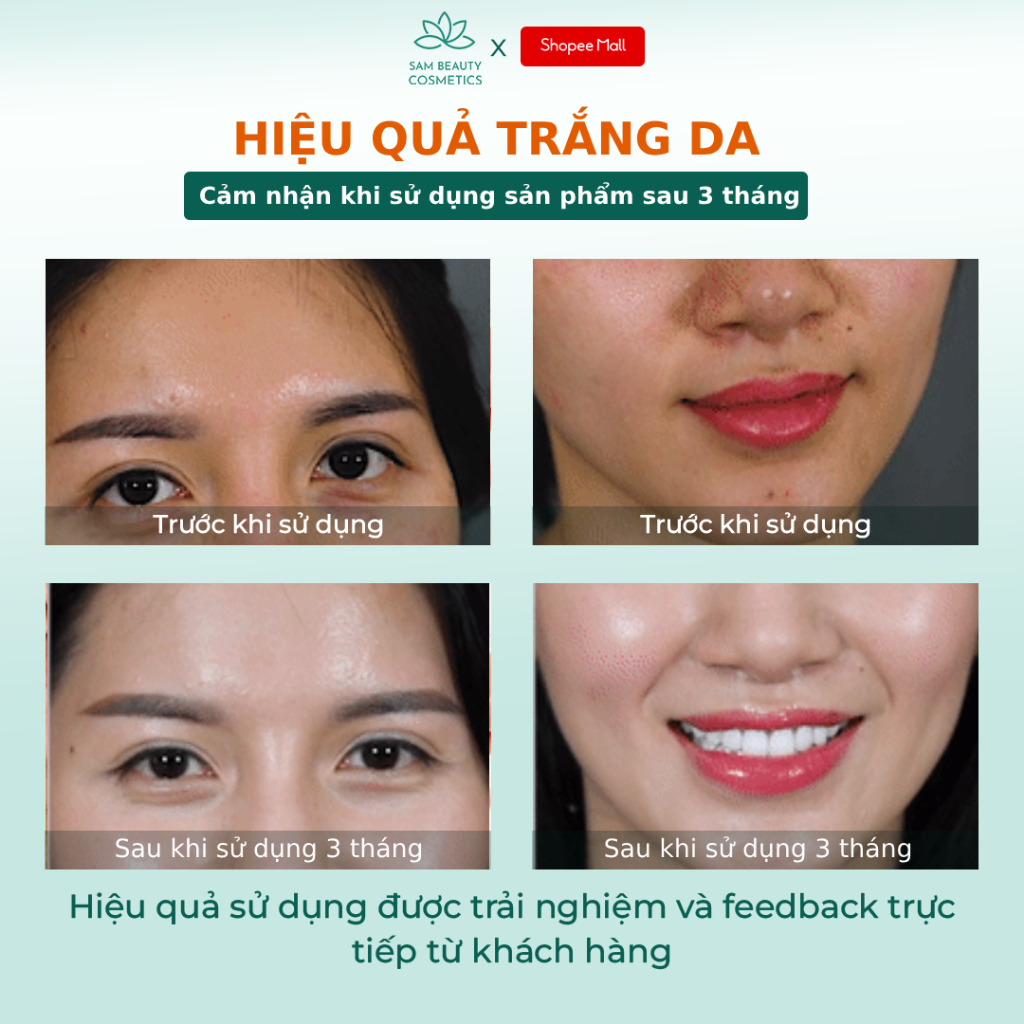 Viên uống trắng da ngừa nám DR.LACIR glutathione 600 hộp 30 viên DR22