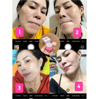 𝐊𝐄𝐌 𝐅𝐀𝐂𝐄 𝟐 𝐓Ầ𝐍𝐆 𝐌𝐘𝐎̂💯 (dưỡng trắng phục hồi da)