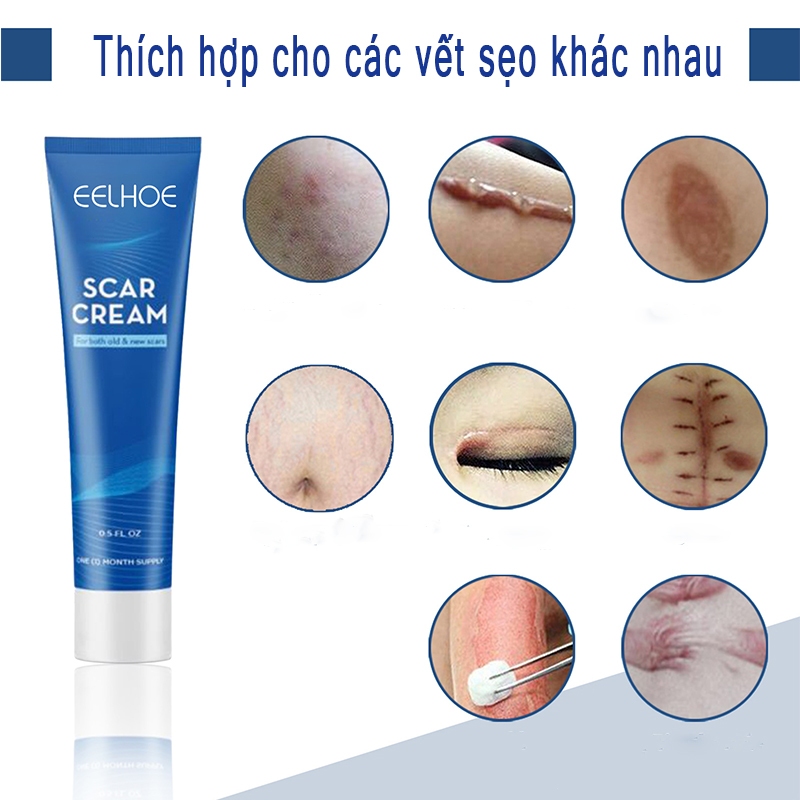 Kem Làm Mờ Phẳng Sẹo Lồi Lõm EELHOE Scar Cream - Kem EELHOE Mờ Thâm Sẹo Cứng Lâu Năm Do Mụn, Rạn Thúc Đẩy Phục Hồi