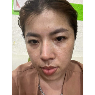 Kem HA Cấp Ẩm Trắng Da