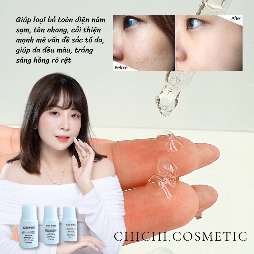 [MẪU THỬ 5ML] Tinh chất khử nám dưỡng trắng In This Moment Arbutin 5x Serum Tom Tit Top 50ml