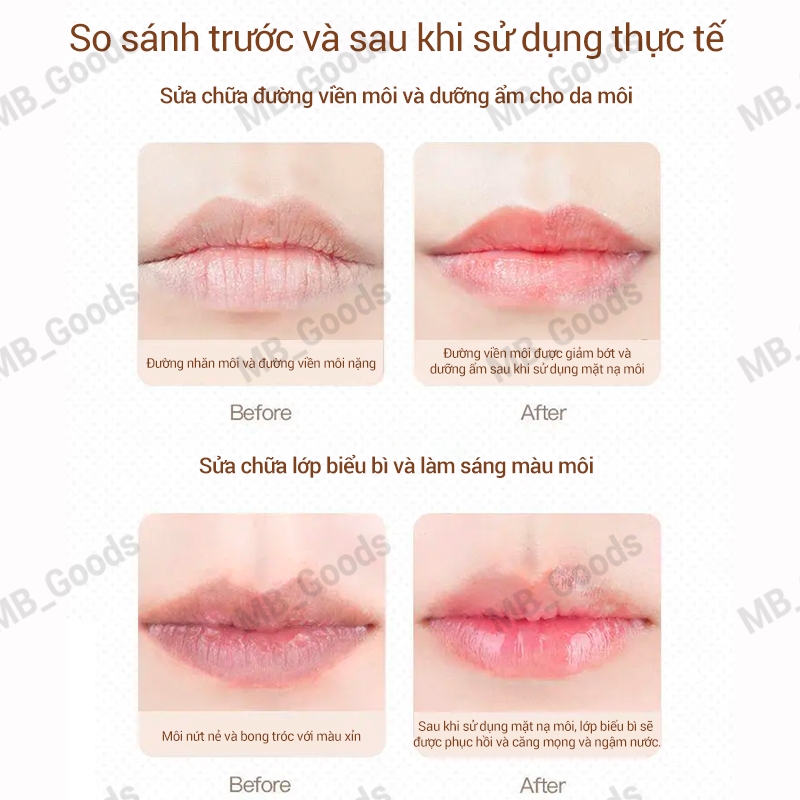 Bộ son dưỡng môi Amortals dưỡng ẩm, dưỡng ẩm, tẩy tế bào chết và giảm nếp nhăn trên môi, son dưỡng môi