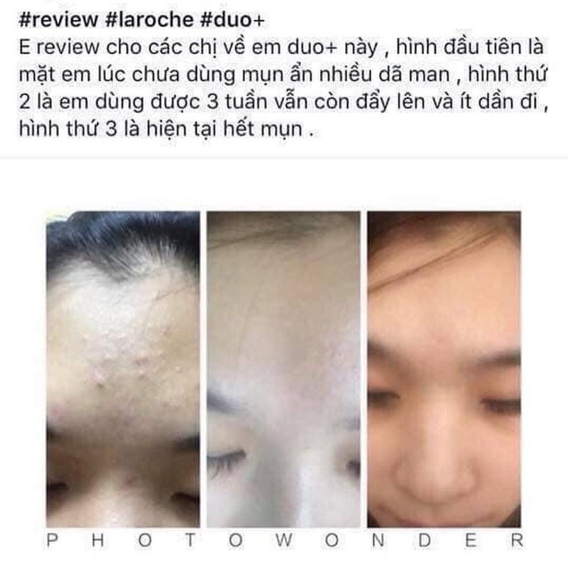Kem Giảm Mụn Ngừa Thâm La Roche Posay Effaclar Duo+