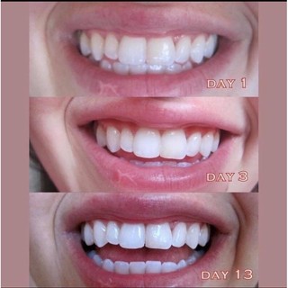 Kem đánh răng C.rest Pro-Health Advanced Whitening