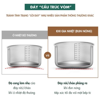 Bộ nồi inox Edelkochen All Day Collection (Quánh 16cm/ Nồi 20cm/ Nồi 24cm)