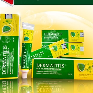 Kem bôi dermatitis thụy sỹ hỗ trợ nấm ngứa, da cơ địa