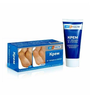 Kem Trị Nứt Gót Chân Nga Kpem 50ml (tuýp)