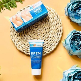 Kem Trị Nứt Gót Chân Nga Kpem 50ml (tuýp)