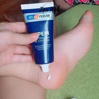 Kem Trị Nứt Gót Chân Nga Kpem 50ml (tuýp)
