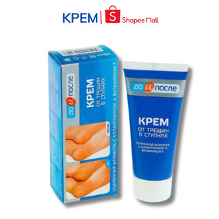 Kem nẻ gót chân Kpem Foot Cream giảm nẻ chân, nứt chân, khô da chân, dưỡng gót chân