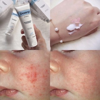 Kem Nẻ Chàm Nội Địa Pháp Dexeryl Creme
