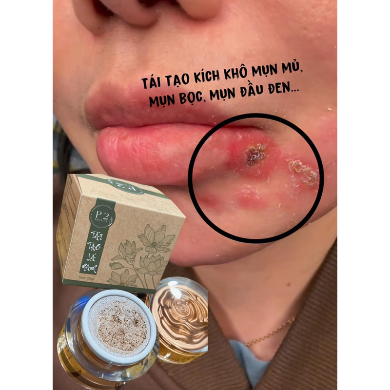 Sỉ 10 hộp kem tái tạo đặc bở handmade
