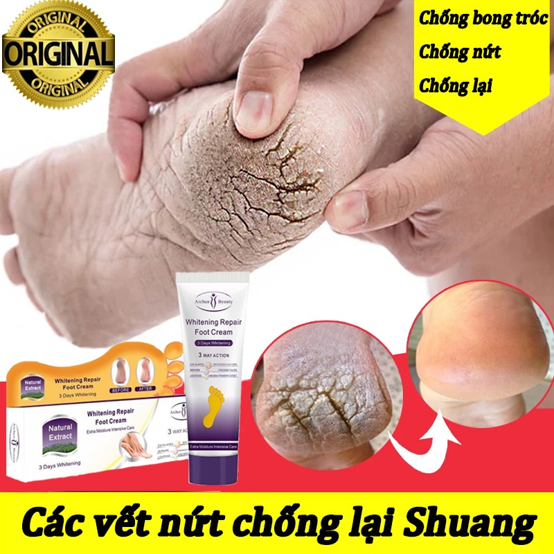foot cream kem trị nứt gót chân thuốc trị nứt gót chân kem dưỡng ẩm chống nứt nẻ gót chân 100g