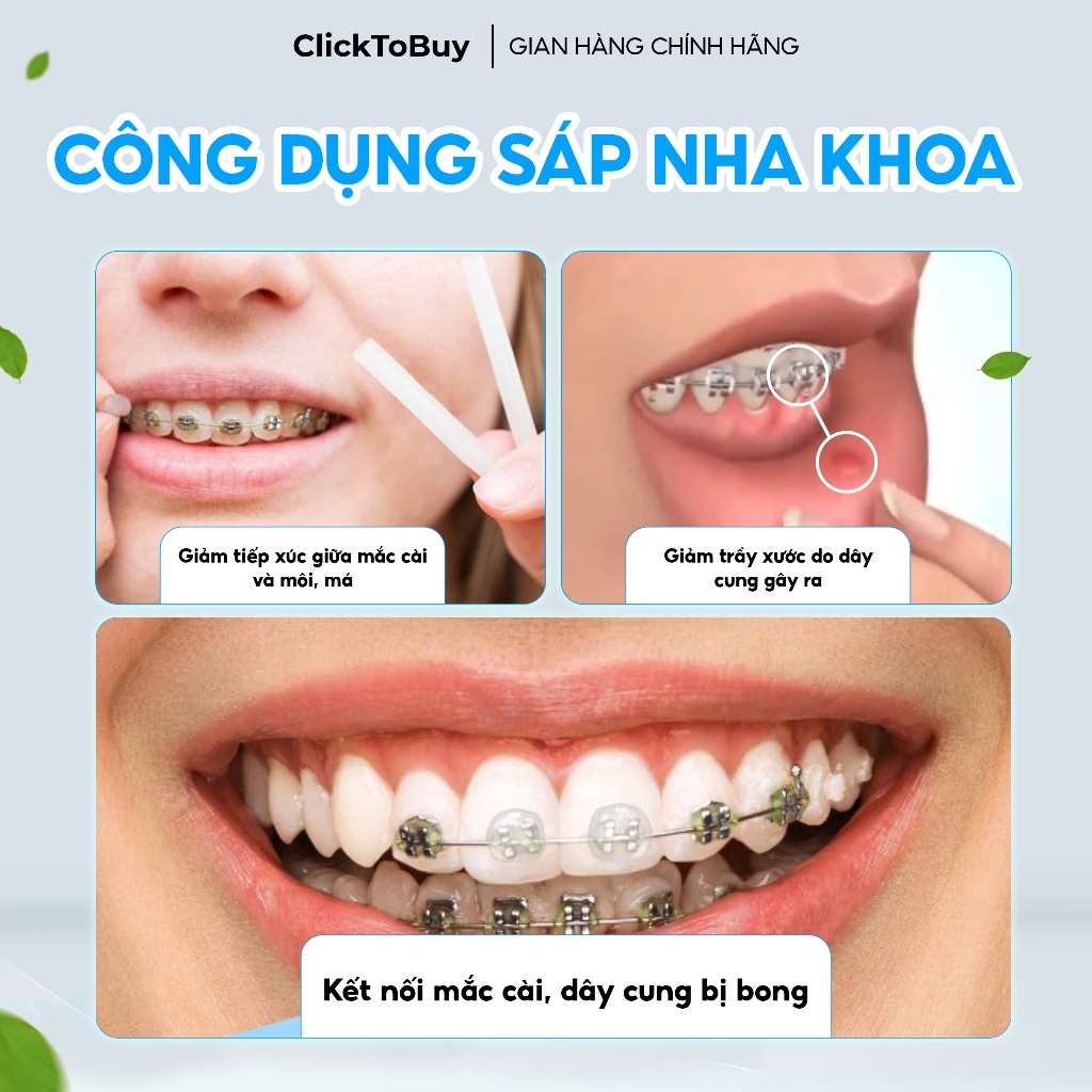 Sáp Nha Khoa Coral 10 mùi, Sáp Giảm Đau Khi Chỉnh Nha, Niềng Răng