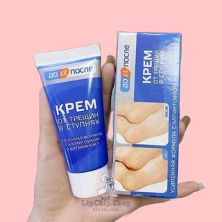 Kem trị nứt gót chân nga kpem 50ml
