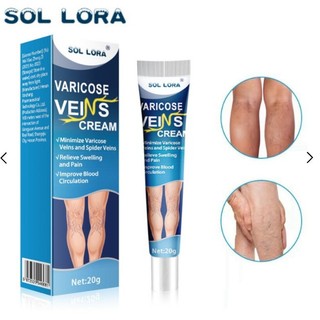 Kem bôi thảo dược suy dãn tĩnh mạch Sol lora , varicose veins cream