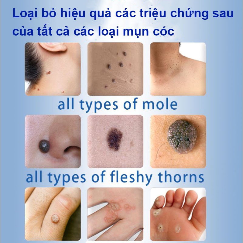 Bút Chấm Mụn Thịt, Tẩy Nốt Ruồi, Xóa Tàn Nhang, thành phần thảo dược 100% an toàn và không đau rát