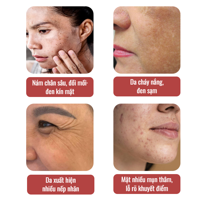 Kem lười nâng tone trẻ hóa da Darlinkey - Kem lười đa năng Hàn Quốc 50g dưỡng ẩm, trắng da, mờ thâm nám,thay thế kem nền