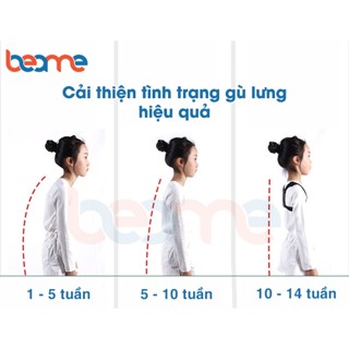 Đai Đeo Chống Gù Lưng Cao Cấp, Đai Chống Gù Lưng Beame Kyphosis FK-212