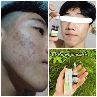 COMBO 2 Hộp Serum Thảo Mộc Xanh