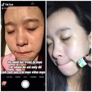 COMBO 2 Hộp Serum Thảo Mộc Xanh