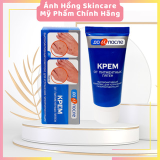 Kem đồi mồi kpem Nga 50ml xóa mờ đồi mồi tay, tàn nhang dưỡng da tay trắng sáng mịn màng