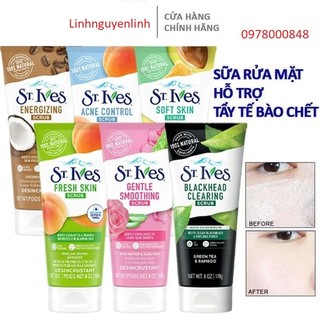 SỮA RỬA MẶT & TẨY DA CHẾT ST.IVEST - TRẮNG DA