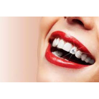 Đá đính răng ( bộ 200 viên + keo + bút )