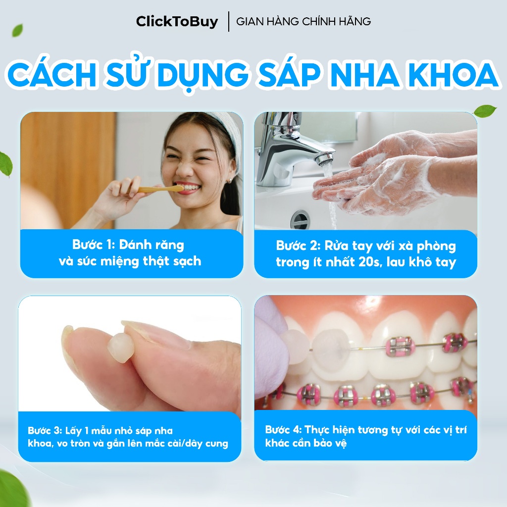 Sáp Nha Khoa, Sáp Giảm Đau Khi Chỉnh Nha, Niềng Răng