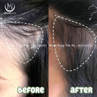 TINH CHẤT MỌC TÓC THẢO DƯỢC - SATO AROVICS