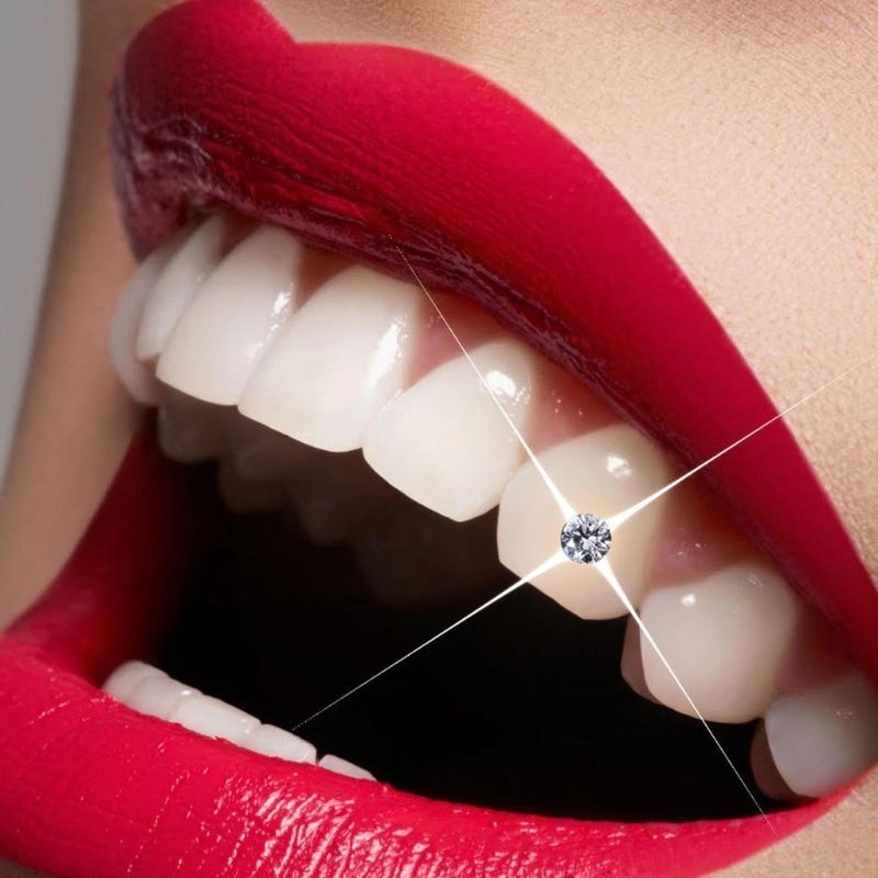 Combo 10 viên đá đính răng Úc _ Sáng đẹp