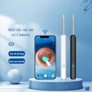 Dụng cụ lấy ráy tai có gắn camera nội soi đa năng kết nối dễ dàng