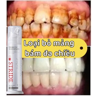 Kem đánh răng làm trắng 100g Loại bỏ mảng bám từ răng của bạn chống sâu răng khử mùi hôi miệng chăm sóc nướu nhạy cảm