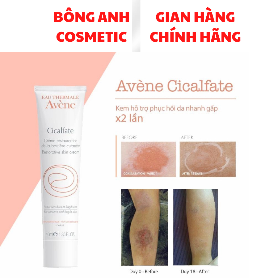 Kem làm dịu hồi phục da Avene Cicalfate Repair Cream (Pháp)