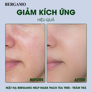 Mặt nạ Bergamo Help Mask Pack Tea Tree - Tràm trà (Miếng)
